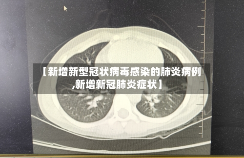【新增新型冠状病毒感染的肺炎病例,新增新冠肺炎症状】