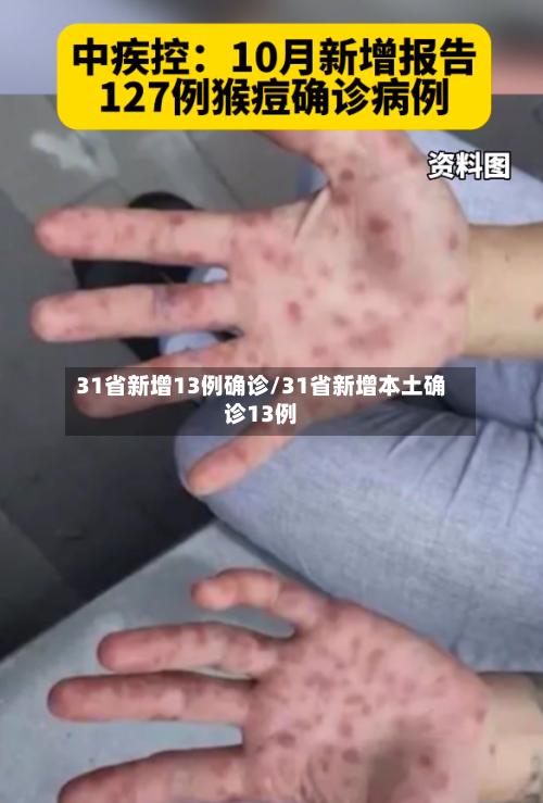 31省新增13例确诊/31省新增本土确诊13例